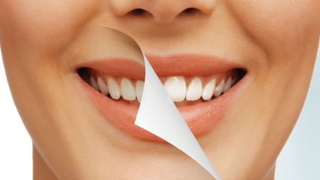 7 Teeth Whitening Products That Will Leave You Smiling!