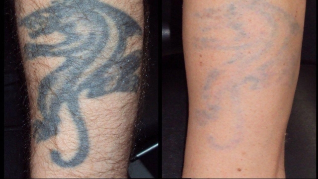 Tattoos Like A Form Of Self Harm