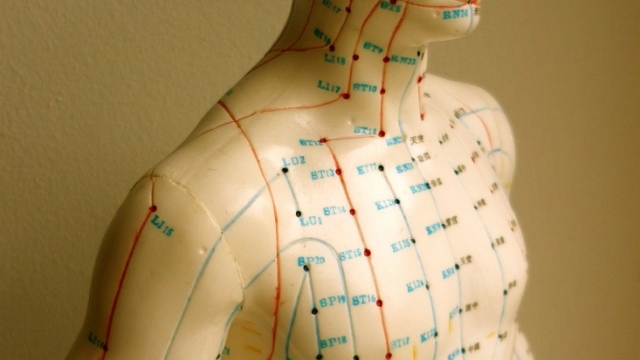 The Art of Healing: Exploring the World of Acupuncture